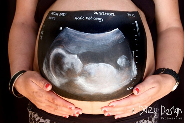 c48f5ee854ff3978259a74b24de1e3ae